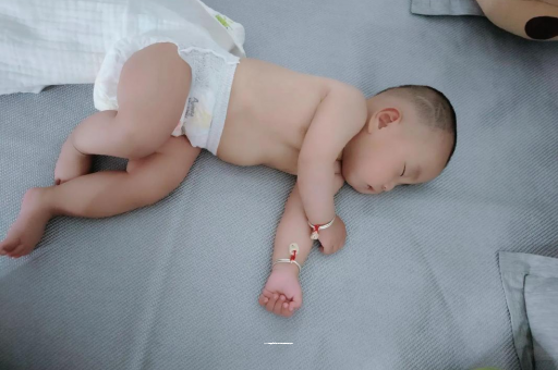 慈利六个月宝宝眼睛散光